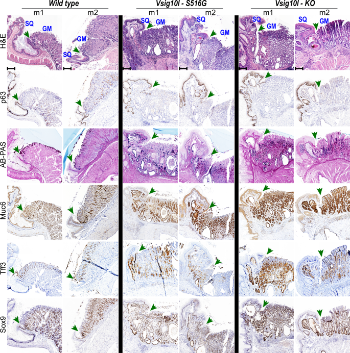 Fig. 5: BEMM lesions in Vsig10l-mutant mice recapitulate the histologic and molecular characteristics of human BE.