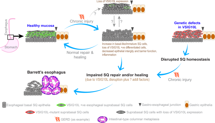 Fig. 7: A hypothetical representation on the potential role of VSIG10L in BE pathobiology.