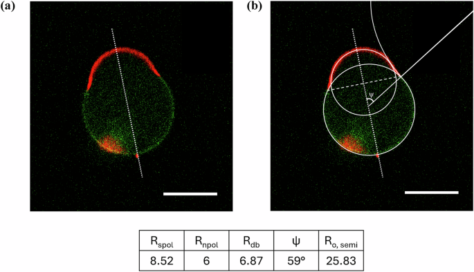 Fig. 7: Shape contour analysis for an axisymmetric two-domain vesicle.
