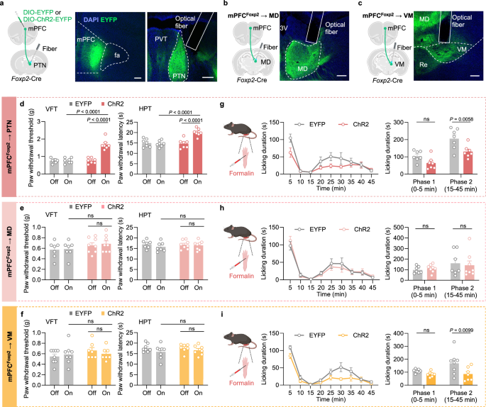 Fig. 4: Projection-specific effects of the mPFC Foxp2+ neurons on acute nociception.