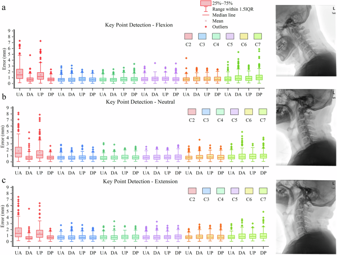 Fig. 1: Box diagram of vertebral body detection C2-7.