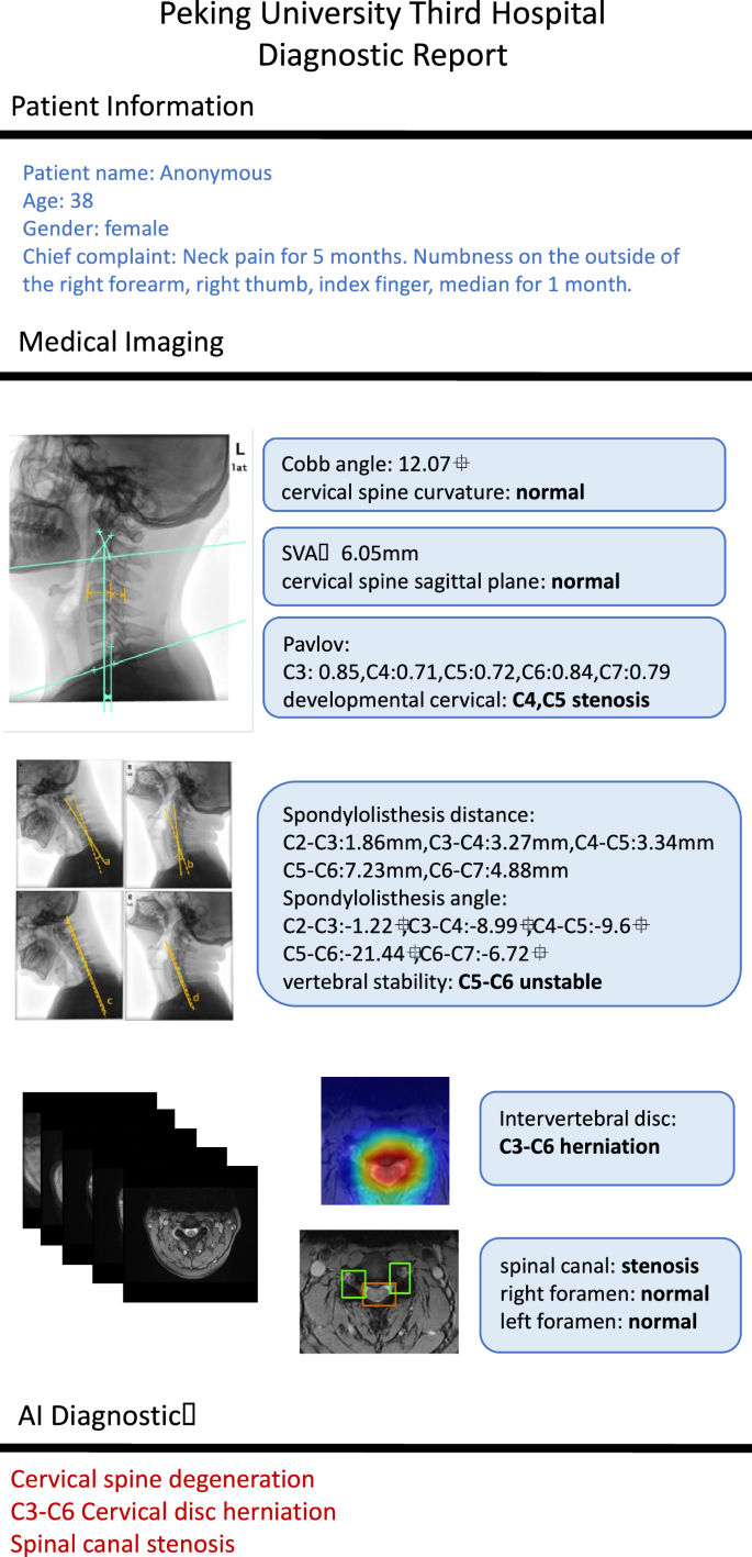 Fig. 8: A visualized diagnostic report of a real case.