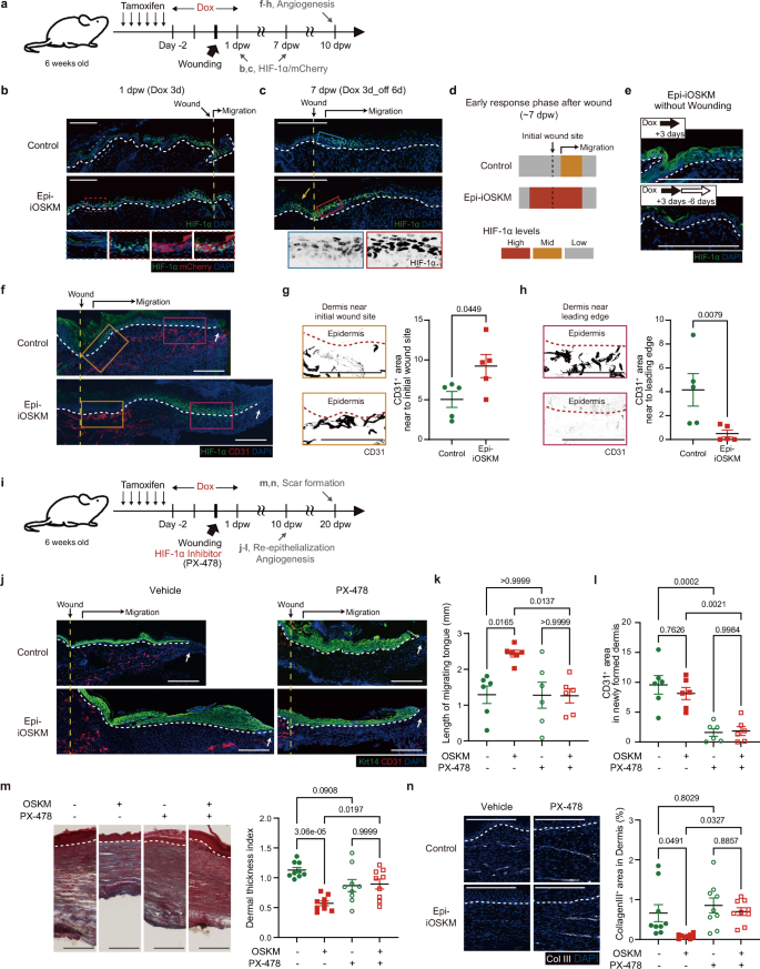 Fig. 7: HIF-1α activation enhances epidermal and dermal repair in Epi-iOSKM skin.