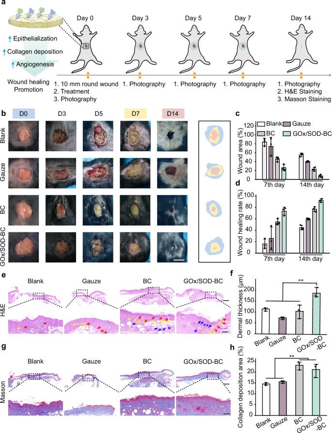 Fig. 5: Evaluation of GOx/SOD-BC dressing for chronic wound healing in a db/db mouse model.