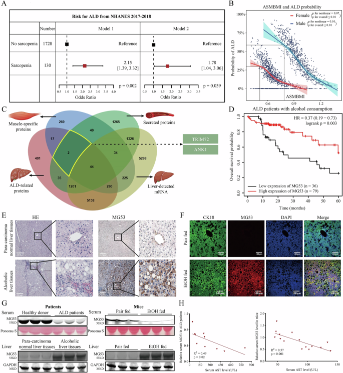 Fig. 1: Alcoholic liver disease (ALD) induces MG53 translocation from circulation to liver tissues.