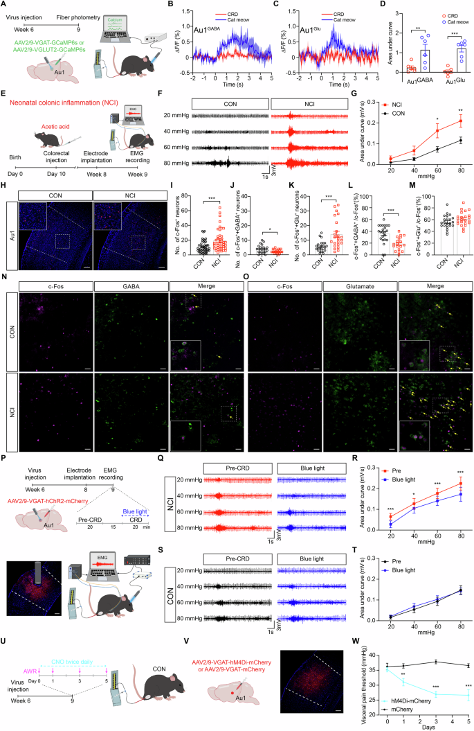 Fig. 1: NCI-induced suppression of Au1GABA neurons drives visceral hypersensitivity.