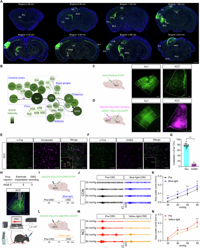 Fig. 2: ACCGlu neurons serve as the downstream effectors of Au1 in modulating visceral pain.
