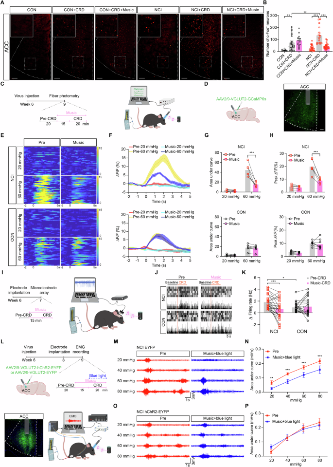 Fig. 5: Music induces visceral analgesia in NCI mice by suppressing ACCGlu neuronal activity.