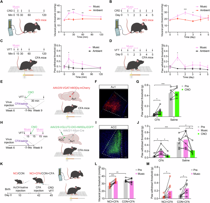 Fig. 6: Au1-ACC neural circuit underlies music-induced somatic analgesia.