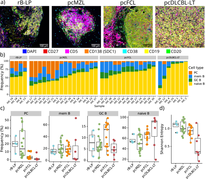Fig. 2: Multiplex IHC-based characterisation of the B cell infiltrates in primary cutaneous B cell lymphoma samples.