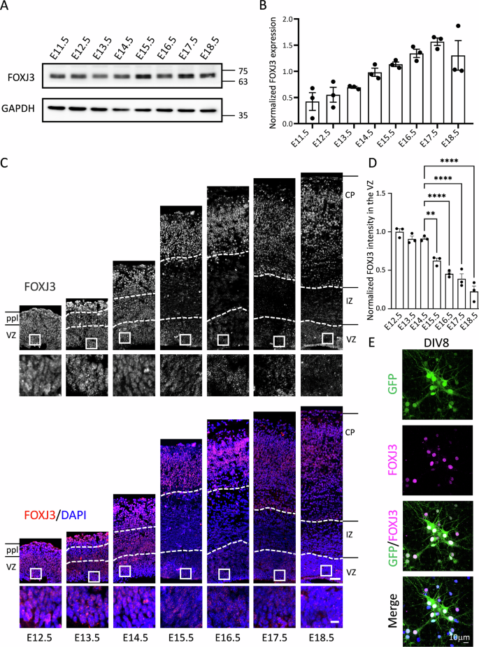 Fig. 2: FOXJ3 is expressed in NSCs in the VZ and neurons in the CP during cortical development.