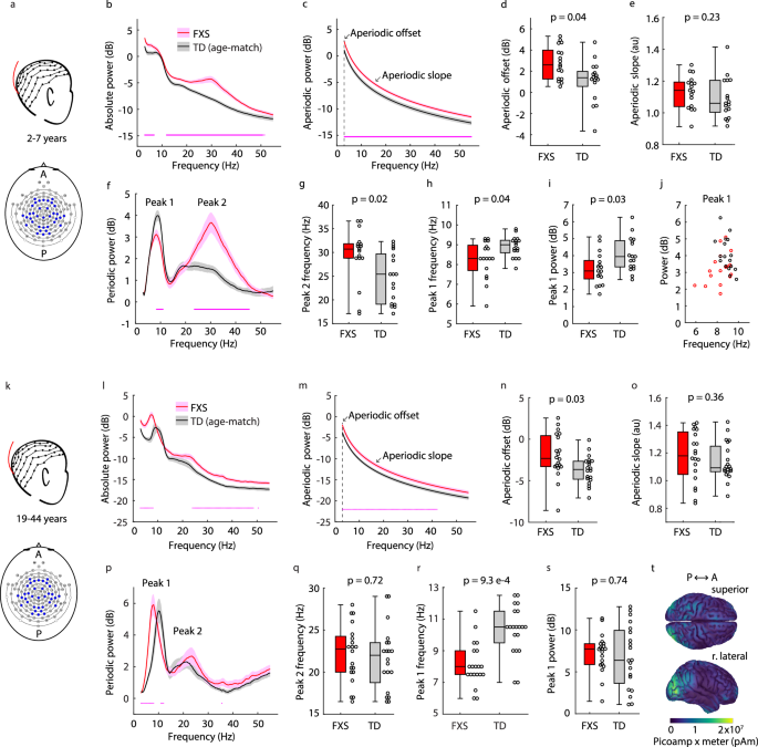 Fig. 1: Cross-sectional developmental trajectories of rsEEG phenotypes of FXS.