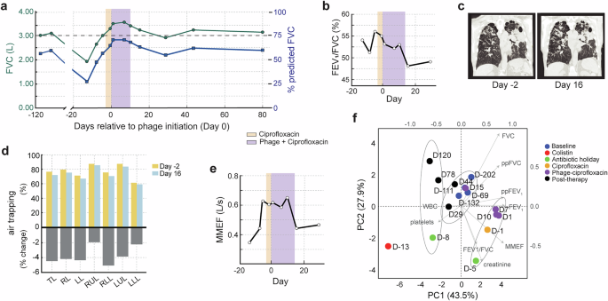 Fig. 2: Co-therapy accelerates airway obstruction relief across functional and radiographic measures.
