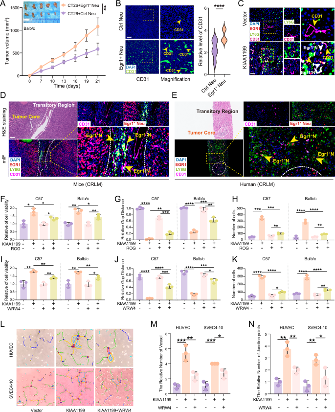 Fig. 6: Egr1⁺ neutrophils drive angiogenesis to accelerate KIAA1199-mediated colorectal liver metastasis.