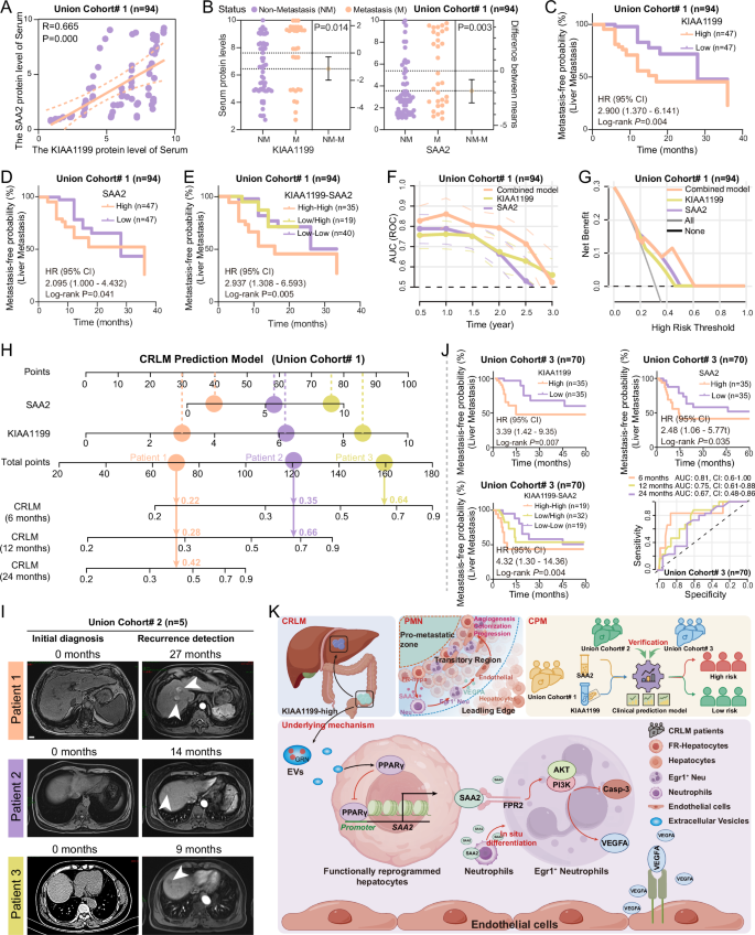 Fig. 7: KIAA1199–SAA2 signature enables precise risk stratification for colorectal cancer liver metastasis.
