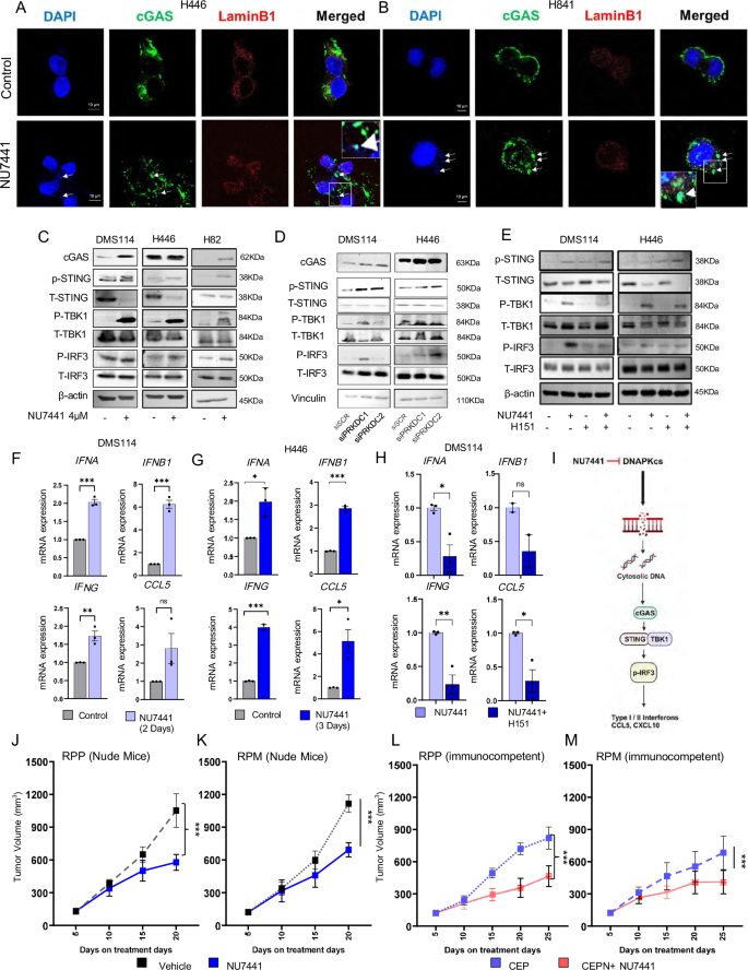 Fig. 3: DNAPKcs inhibition activates cGAS-STING pathway via micronuclei formation and enhances pro-inflammatory interferons.