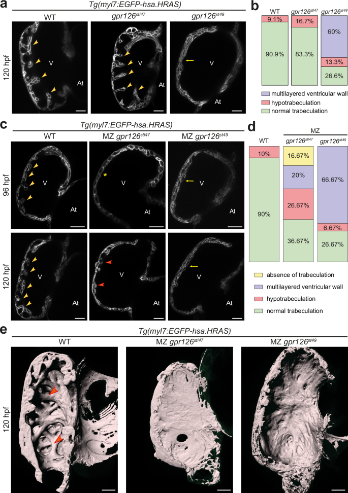 Fig. 2: Gpr126-NTF and -CTF are required for trabeculation.