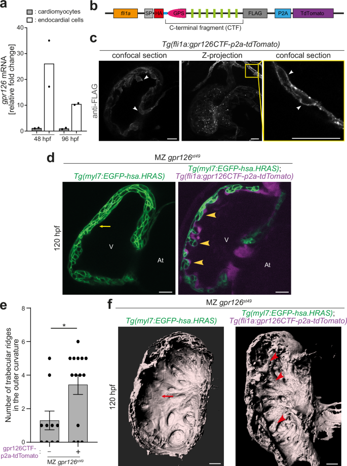 Fig. 3: Endocardial CTF overexpression reinstates trabeculation in MZ gpr126st49 mutants.