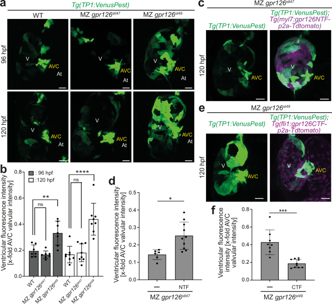 Fig. 6: gpr126 modulates myocardial Notch activity.