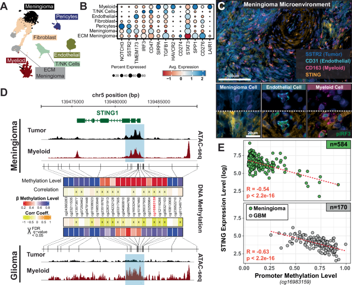 Fig. 3: Increased Chromatin accessibility and promoter hypomethylation drives STING expression across meningioma subtypes.