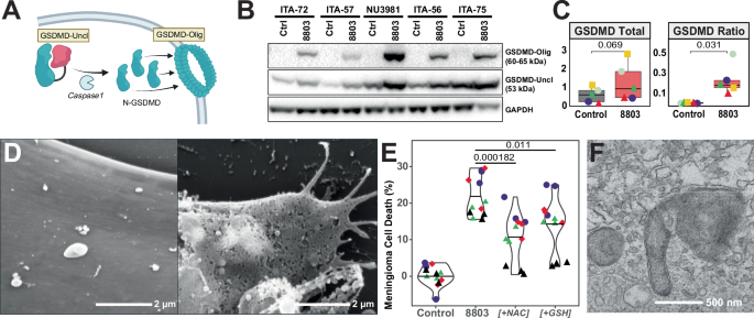 Fig. 5: The STING agonist 8803 triggers meningioma pyroptosis through GSDMD induction.