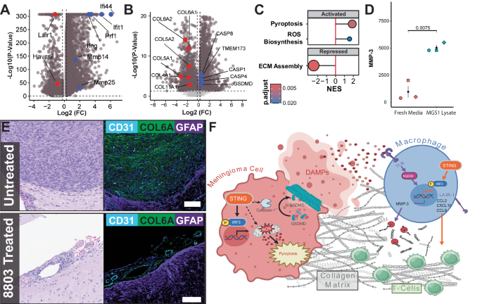 Fig. 9: Meningioma lysis triggers macrophage activation and extracellular matric breakdown through TLR and STING pathways.