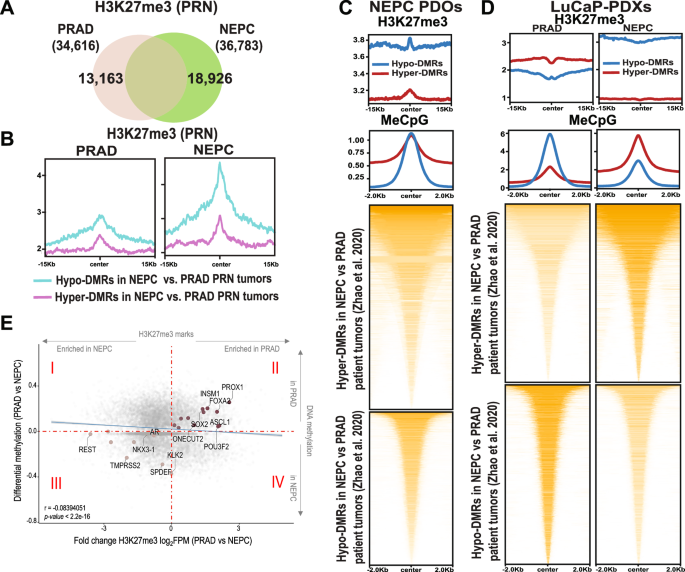 Fig. 2: Increased H3K27me3 deposition at hypomethylated regions in neuroendocrine prostate cancer compared to PRAD.