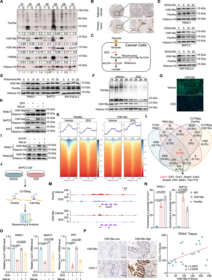 Fig. 3: Enhanced H3K18la by glycolysis-derived lactate promotes the expression of Cxcl1.