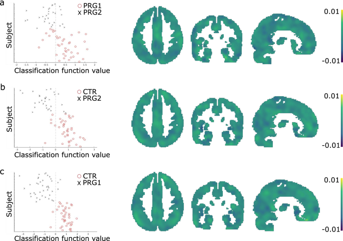 Fig. 2: Classification of groups based on volumetric brain difference maps.