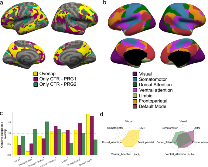 Fig. 3: Overlapping and differing affected areas in the brain across a first and second pregnancy.