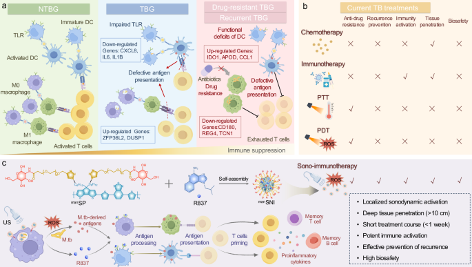 Fig. 2: Concept design of granulomas immune microenvironment-guided TB sono-immunotherapy.