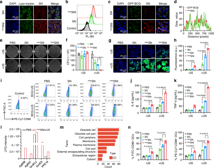 Fig. 4: In vitro targeting and sono-immunotherapy efficacy of manSNI against intracellular M.tb.