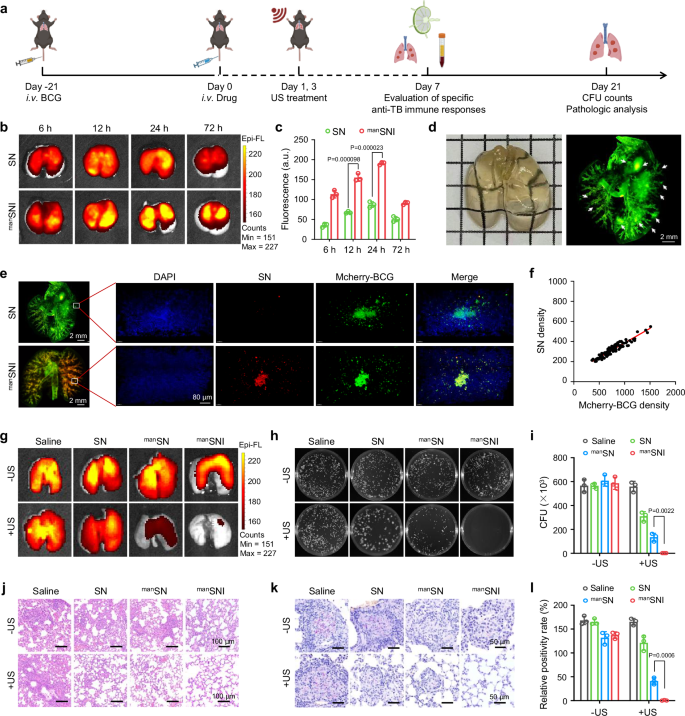 Fig. 5: TBG targeting and anti-TB efficacy of manSNI in vivo.