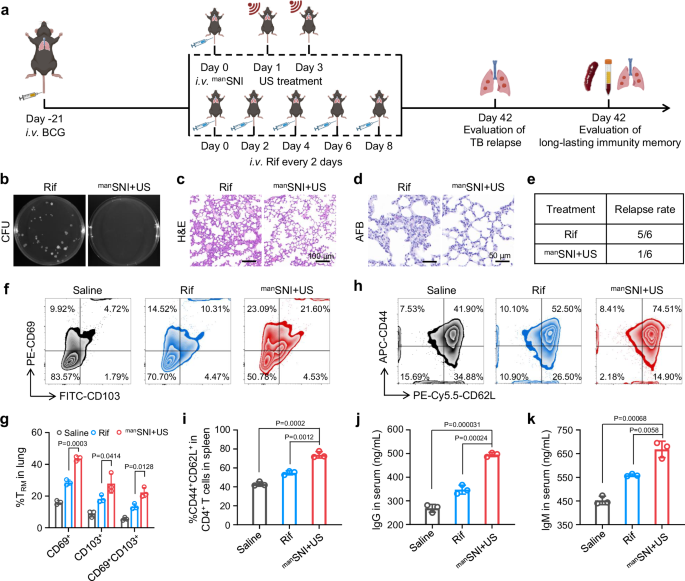 Fig. 7: manSNI-mediated sono-immunotherapy elicits long-lasting memory immunity to prevent endogenous TB relapse.
