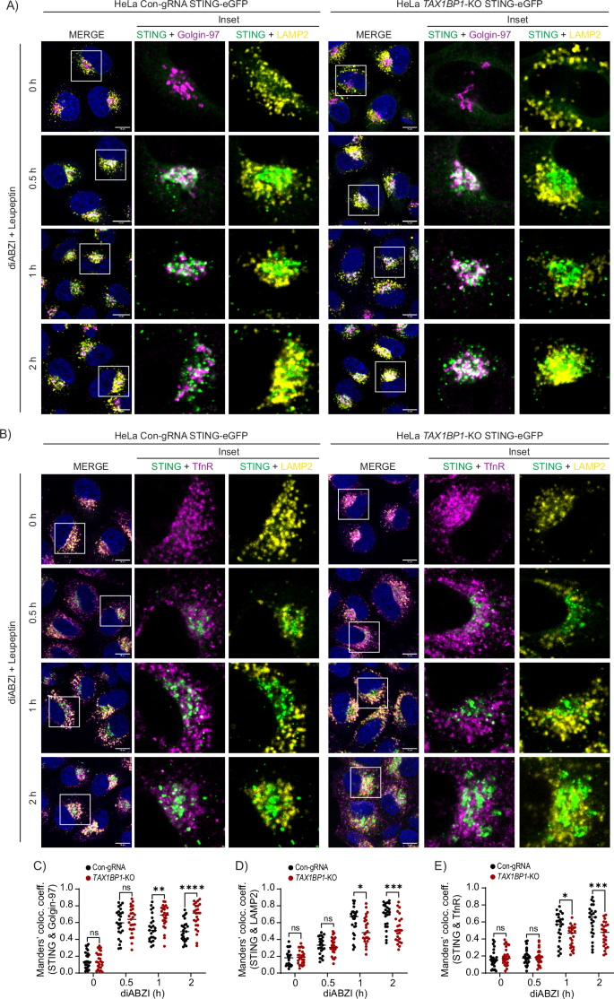 Fig. 6: TAX1BP1 promotes STING trafficking to recycling endosomes and lysosomes.