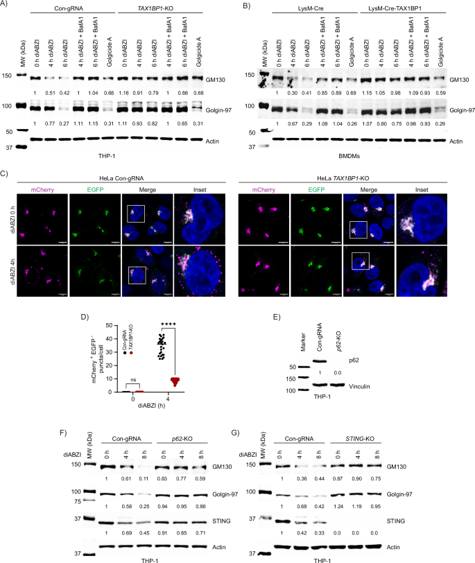 Fig. 8: TAX1BP1 promotes STING-induced Golgiphagy.