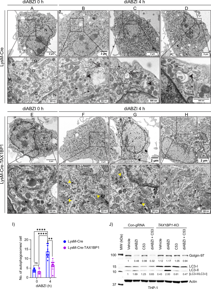 Fig. 9: TAX1BP1 knockout leads to the accumulation of fragmented Golgi upon STING activation.