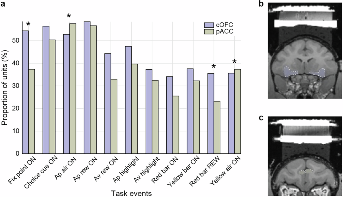 Fig. 3: Event-related neural activity during Ap-Av task.