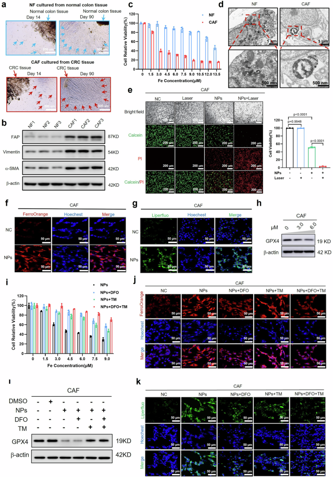 Fig. 2: NPs triggered enhanced ferroptosis of CAFs through the synergistic effect of iron and copper ions.