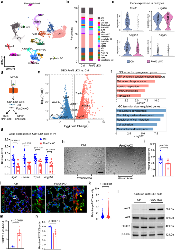Fig. 3: Foxf2 is required for pericyte maturation and migration.