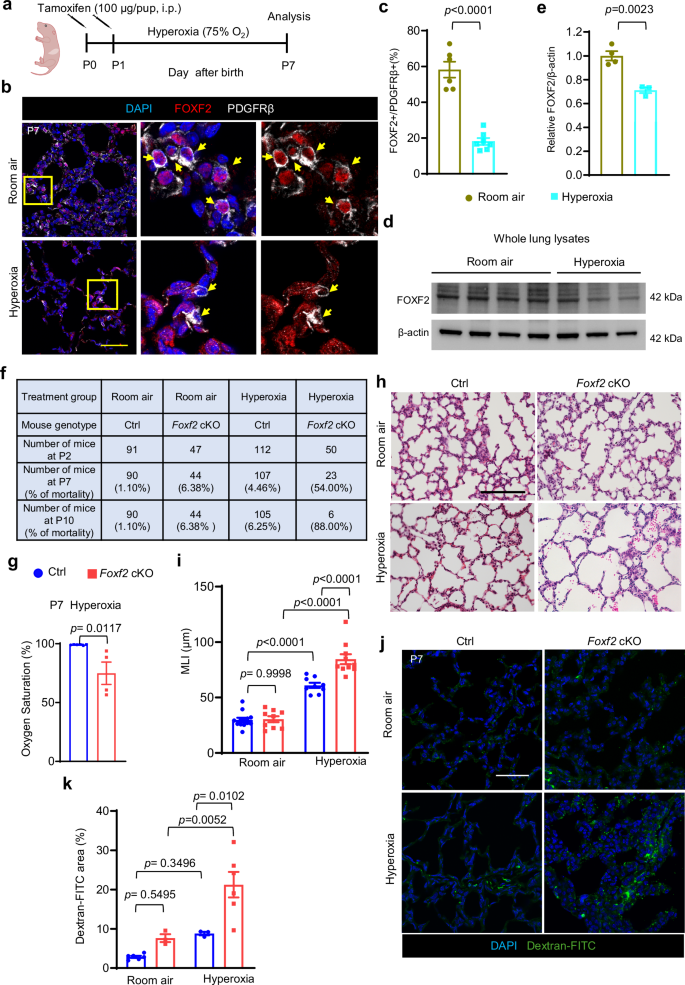 Fig. 4: Foxf2 ablation exacerbates postnatal hyperoxic lung injury.
