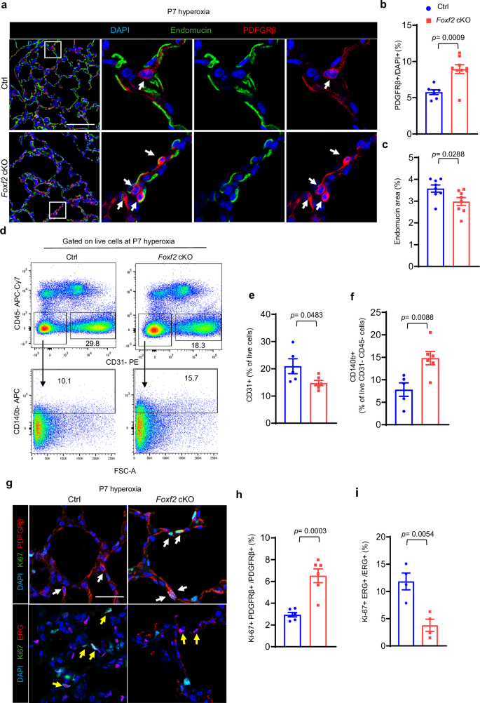 Fig. 5: Pericyte Foxf2 is required for pulmonary angiogenesis following hyperoxic injury.