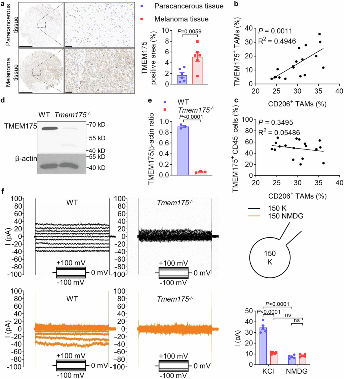 Fig. 1: TMEM175 is elevated in melanoma tissues and related with M2-like TAMs indicating that TMEM175 in myeloid cells should be deleted.