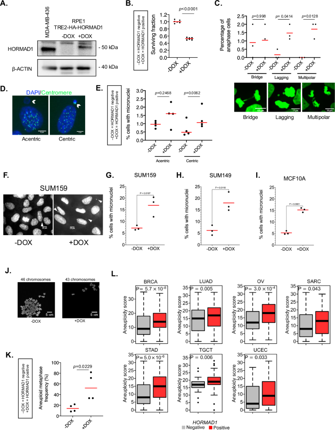 Fig. 1: HORMAD1 expression causes chromosomal instability and aneuploidy.
