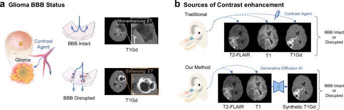 Fig. 1: Identification of glioma BBB status.
