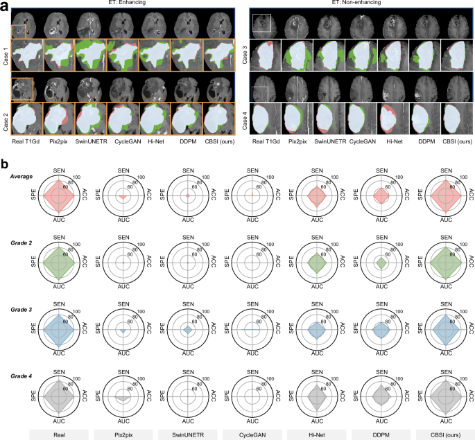 Fig. 5: Downstream tasks evaluation.