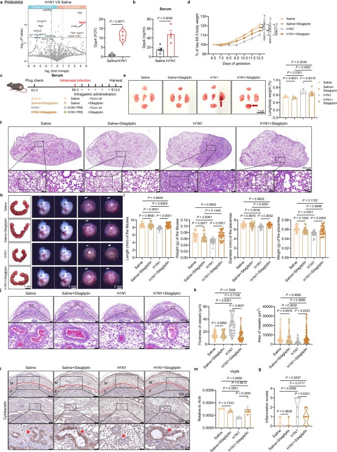 Fig. 2: Inhibition of DPP4 alleviates intrauterine growth restriction caused by respiratory influenza virus infection.