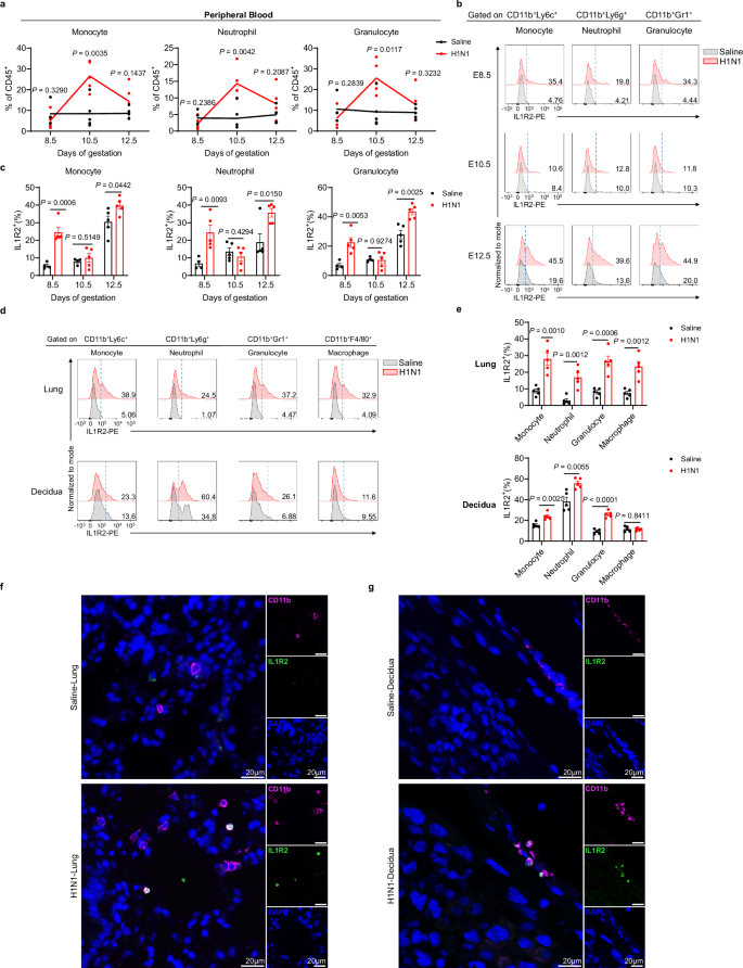 Fig. 4: Increased IL1R2 mainly expresses on CD11b+ myeloid cells.