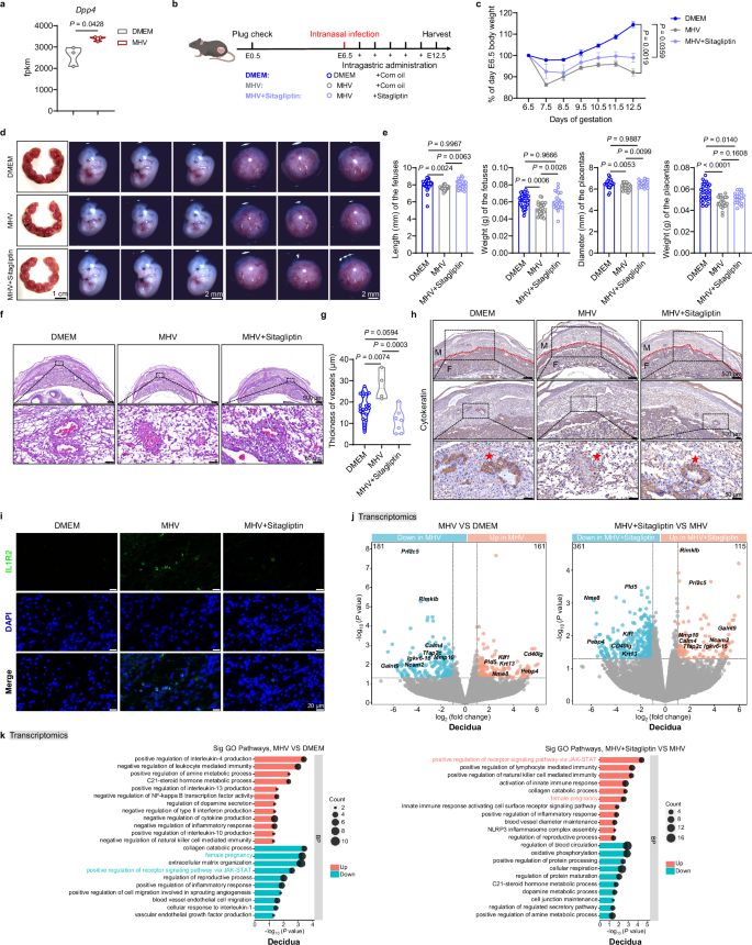 Fig. 7: Inhibition of DPP4 alleviates intrauterine growth restriction caused by pulmonary coronavirus infection modeled by intranasal MHV inoculation.