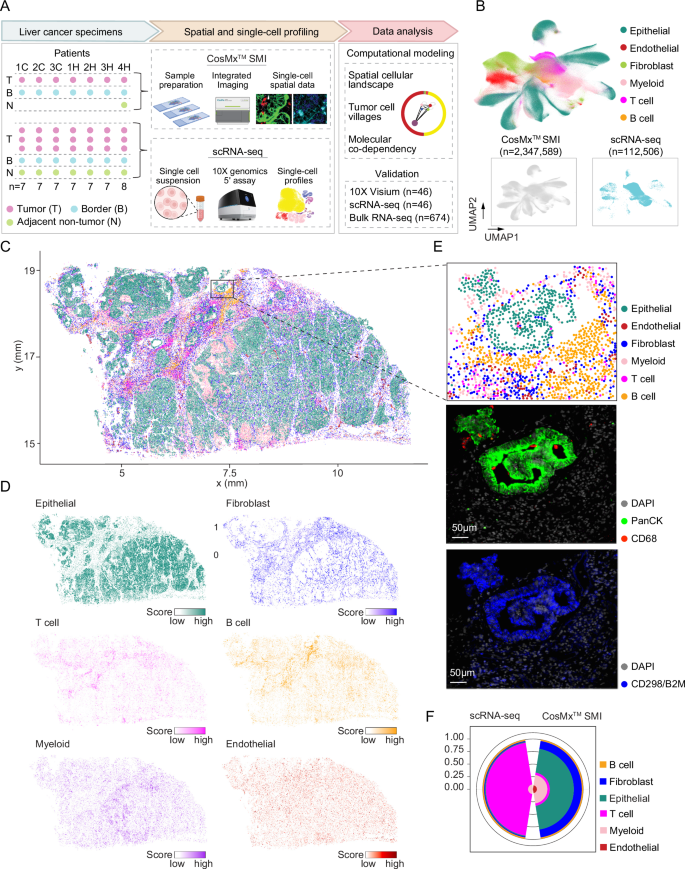 Fig. 1: Single-cell spatial transcriptomic profiling of primary liver cancer.